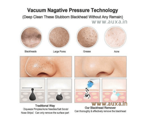 Vacuum Suction Pore Cleaner